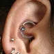 Does Daith Piercing Help Treat Migraine?