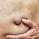 Direct vs. Indirect Hernia