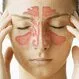Sinus Infection (Sinusitis) Symptoms & Treatment