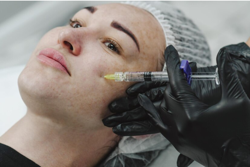 Non-surgical PRP Skin